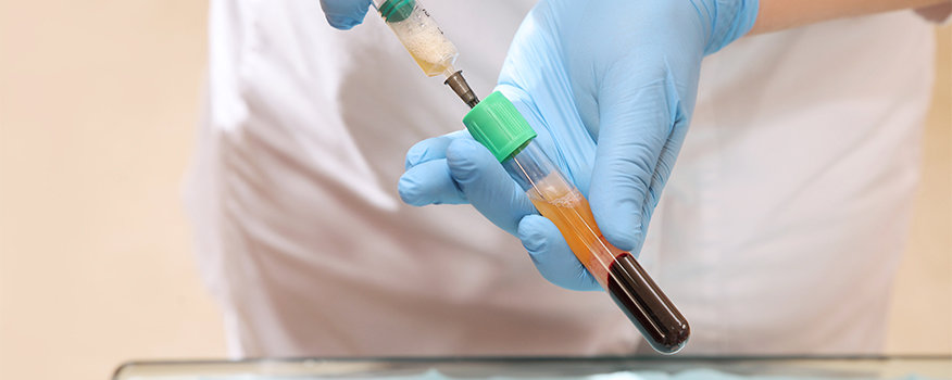 Orthopedic Regeneration: Treating Sports Injuries with Regenerative Medicine Washington. MO