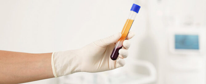 prp injections for knee pain in washington