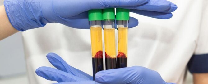 Treating Thinning Hair With PRP Injections Washington, Missouri